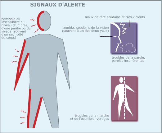 Signaux d'alerte